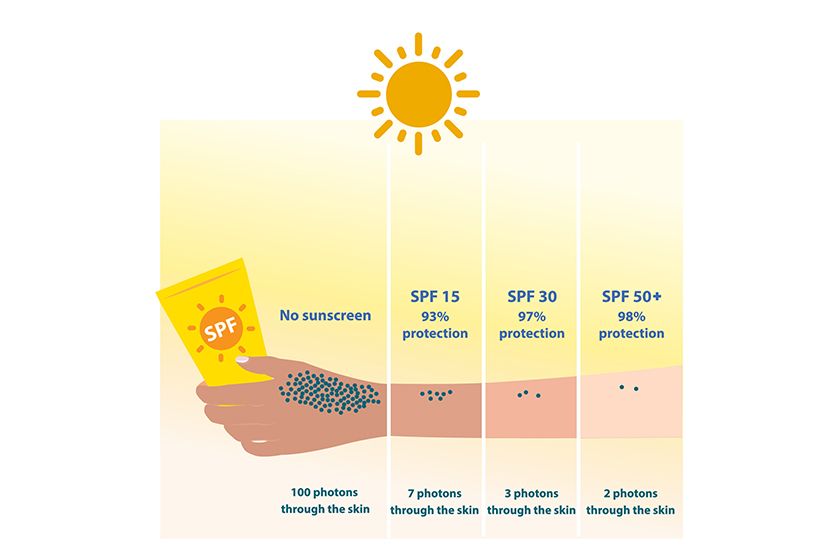 the-different-levels-of-spf-15-30-and-50-protect-uvb-rays-and-allow-photons-through-the-skin-comparison-of-sun-protection-with-sunscreen-skin-ca